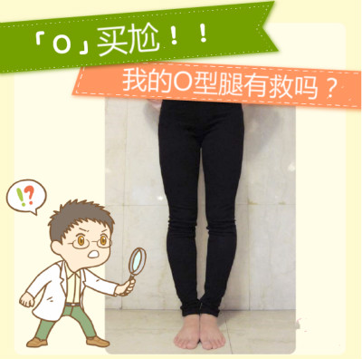 ”O(jiān)” 買(mǎi)尬～四招搶救 O 型腿！