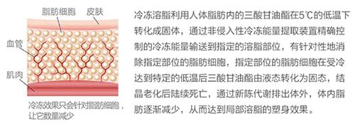 冷凍溶脂減肥儀有效嗎？