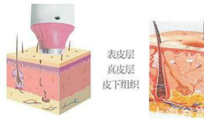 什么叫RF射頻技術(shù)？