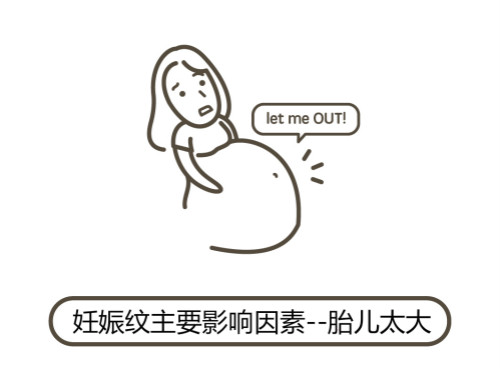 一文秒懂！妊娠紋肥胖紋保養(yǎng)、治療及預(yù)防全攻略