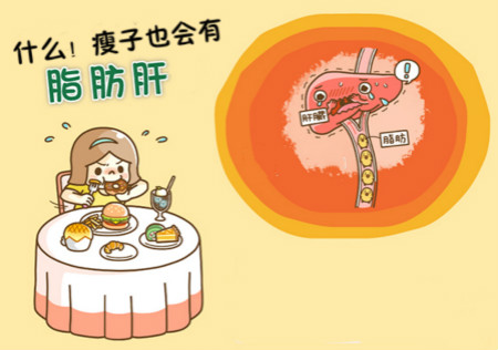 什么！瘦子也會有「脂肪肝」？