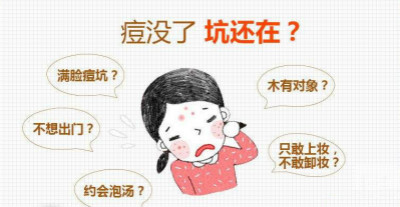 激光去痘印方法你適合嗎？