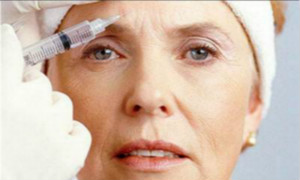 美容儀器廠家?guī)懔私忪o態(tài)皺紋和動(dòng)態(tài)皺紋